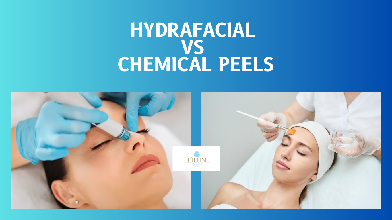 Hydrafacial vs Chemical Peels: Which One Is Right for You?